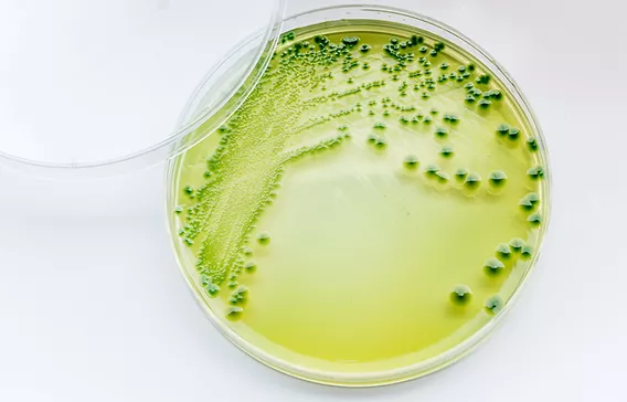 Precise bacteria count in minutes instead of days